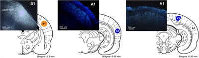 Basal Forebrain Nuclei Display Distinct Projecting Pathways and Functional Circuits to Sensory Primary and Prefrontal Cortices in the Rat